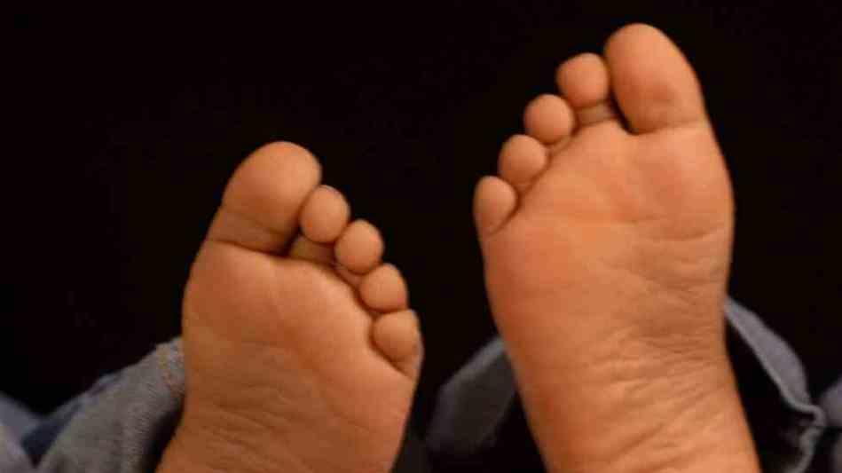 Feet with calluses